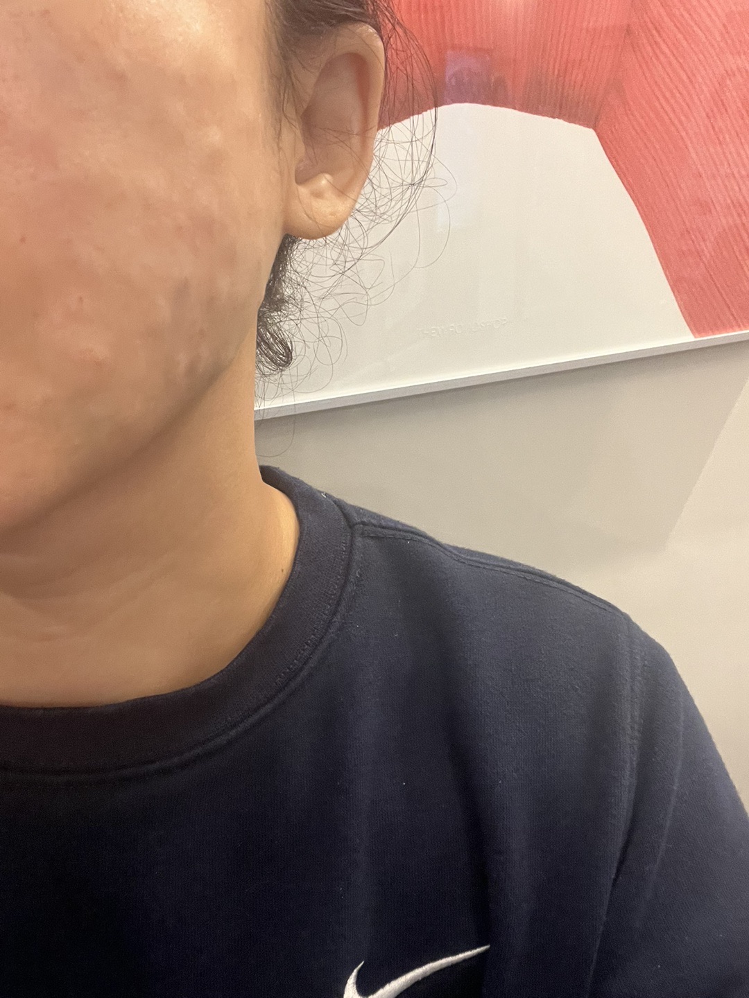 수술후기이미지