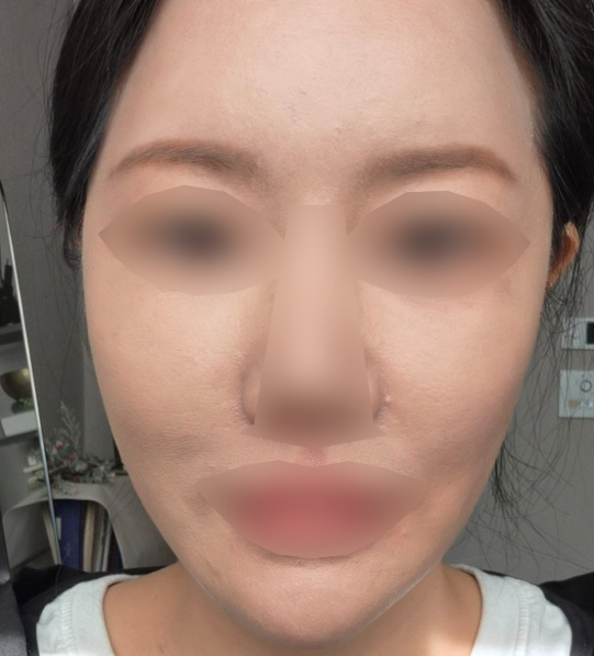 수술후기이미지