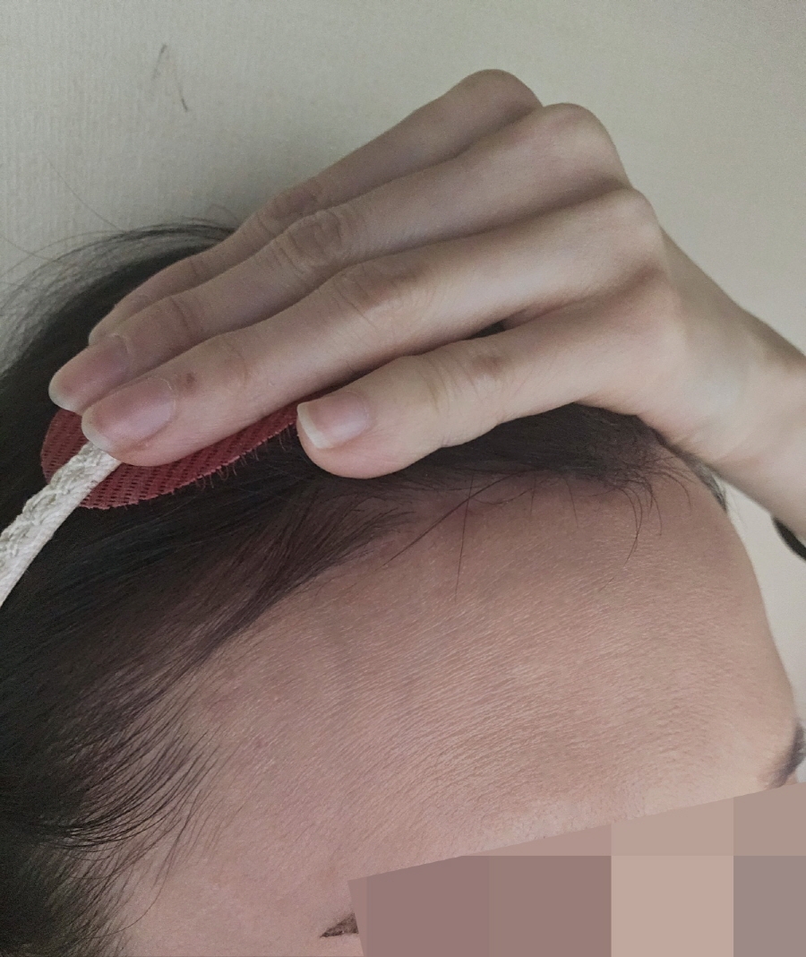 수술후기이미지