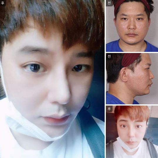 수술후기이미지