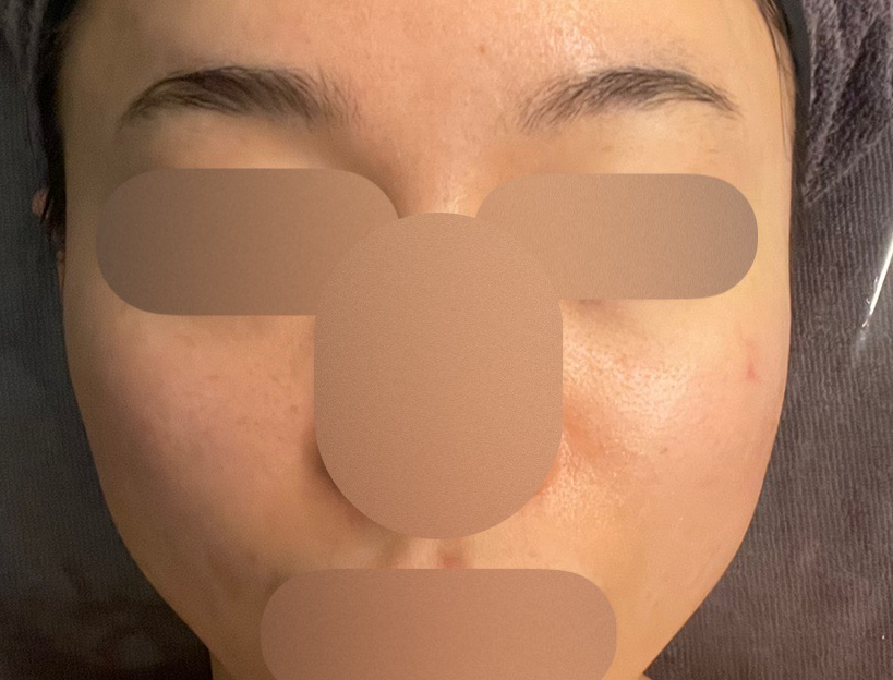 수술후기이미지