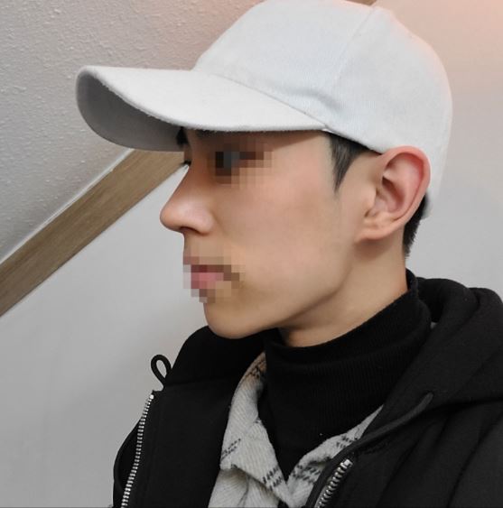 수술후기이미지