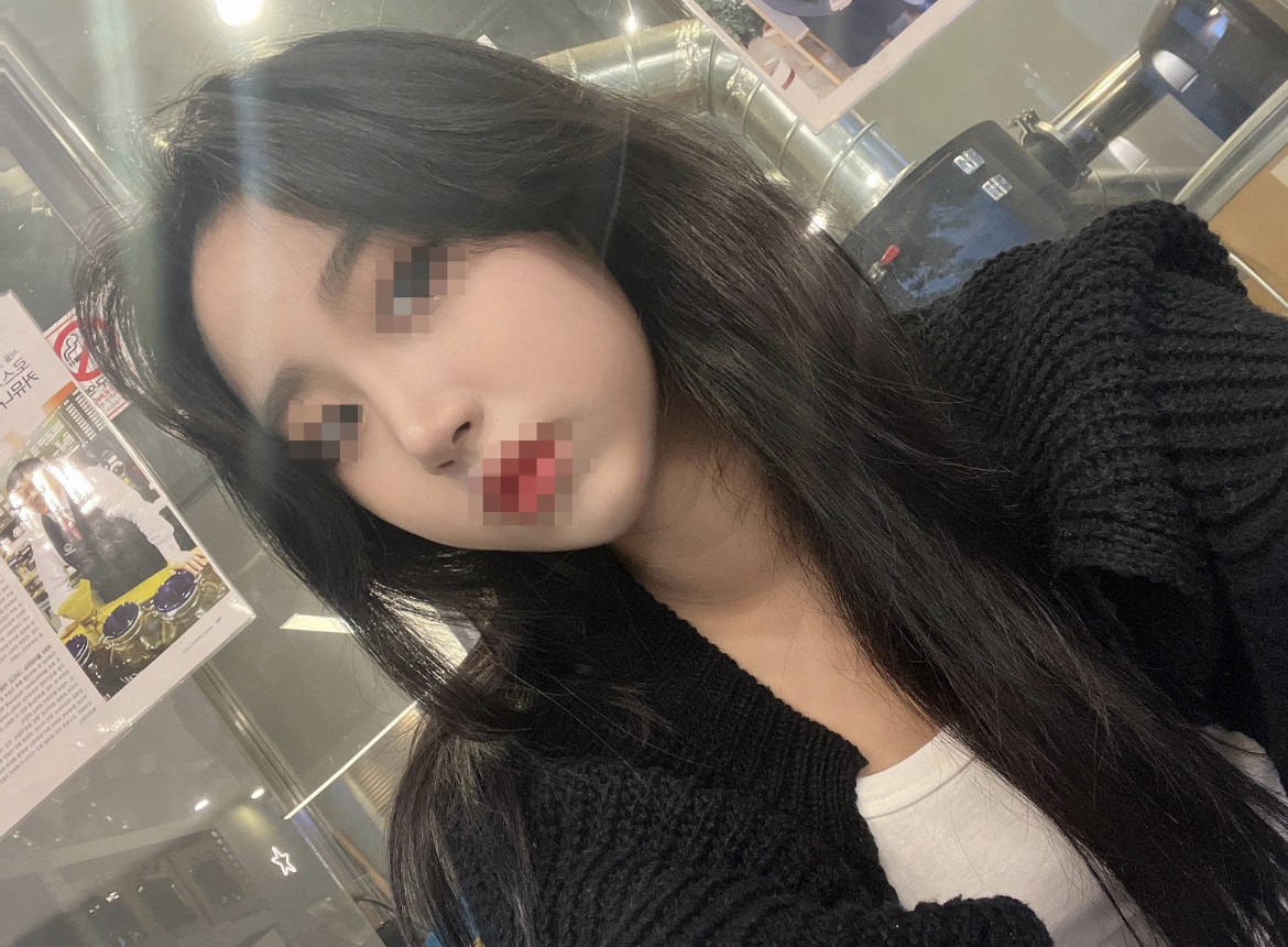 수술후기이미지