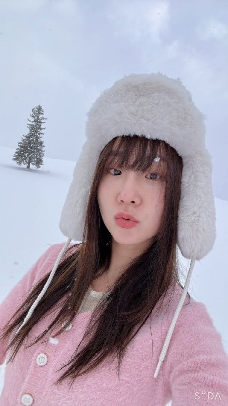 수술후기이미지