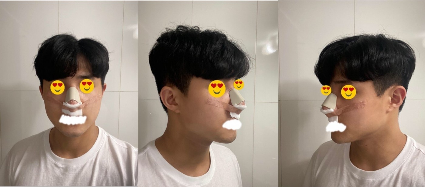 수술후기이미지