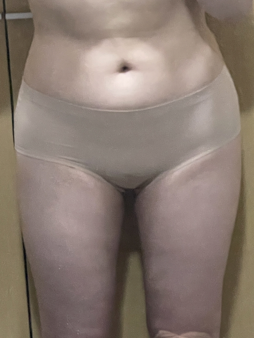 수술후기이미지