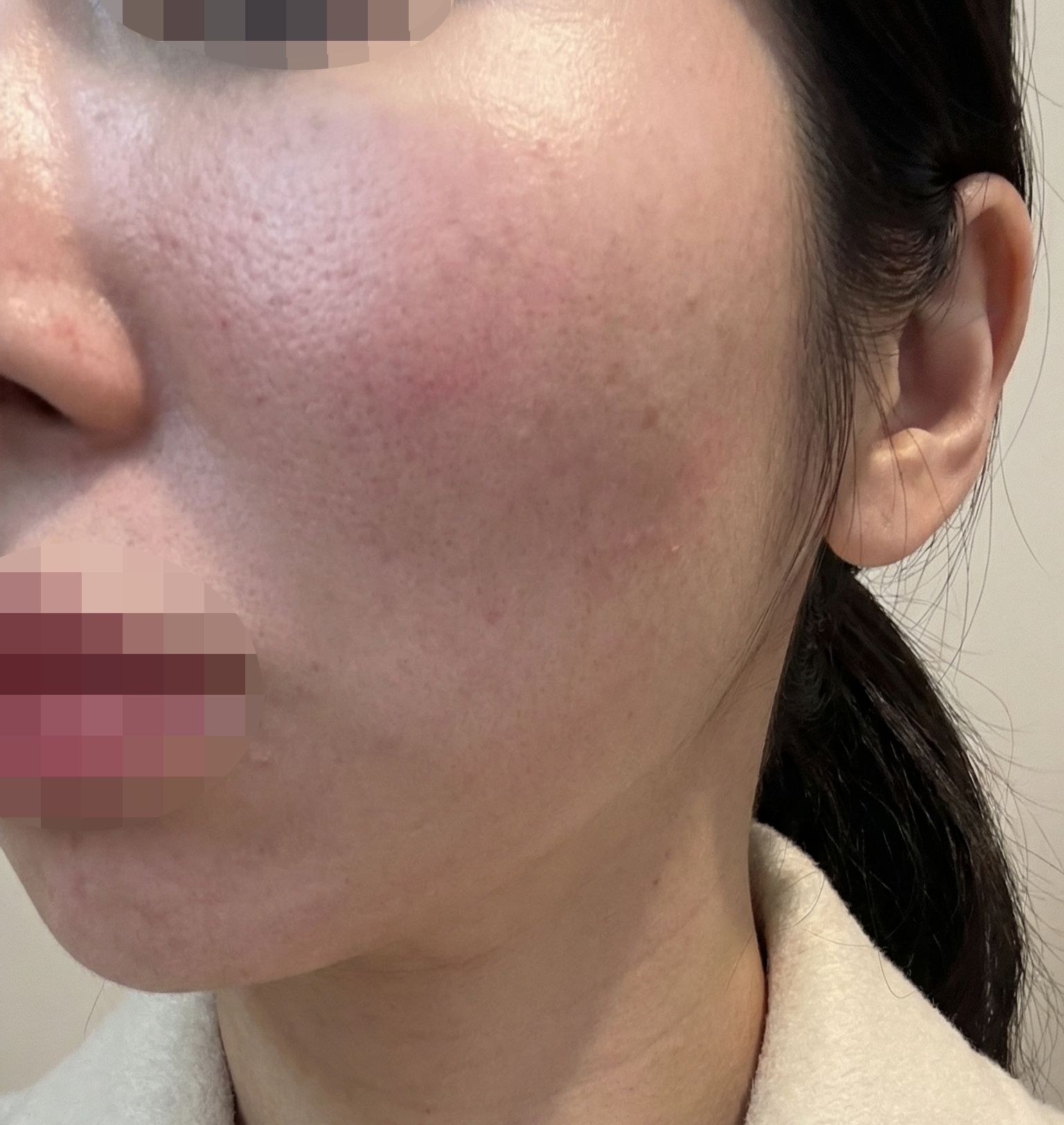 수술후기이미지