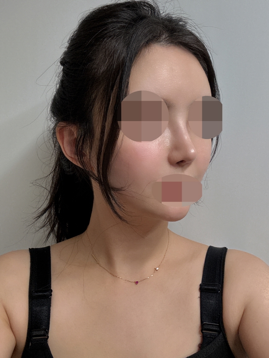 수술후기이미지