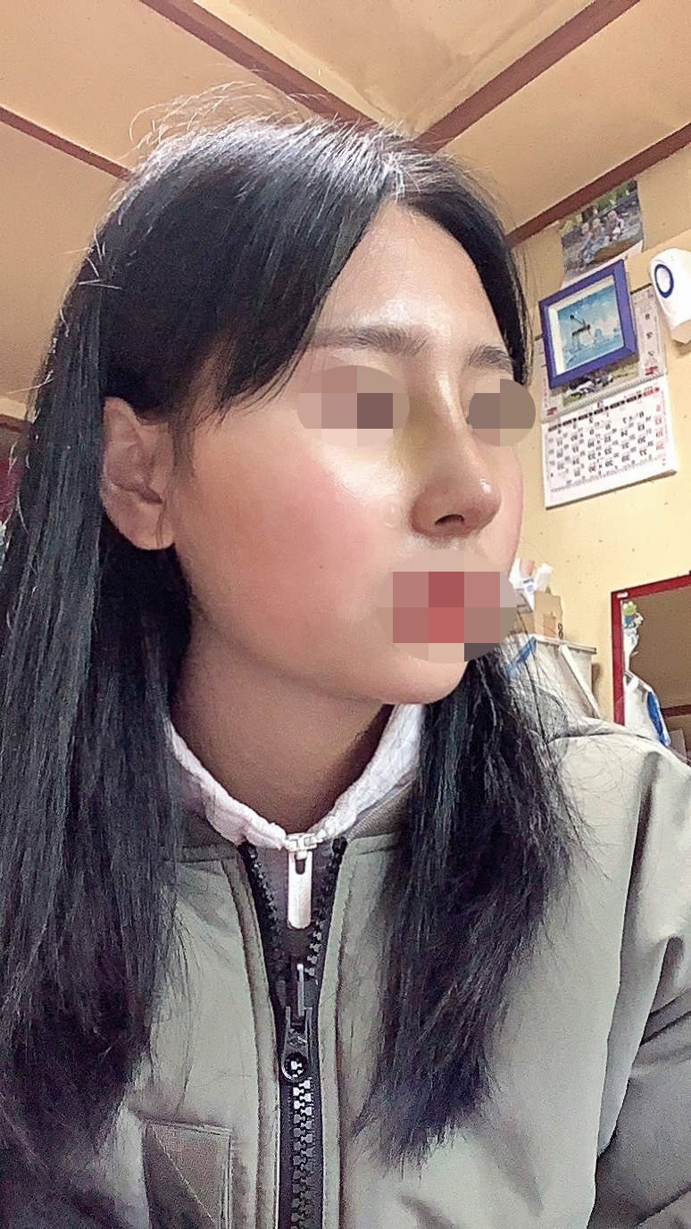 수술후기이미지