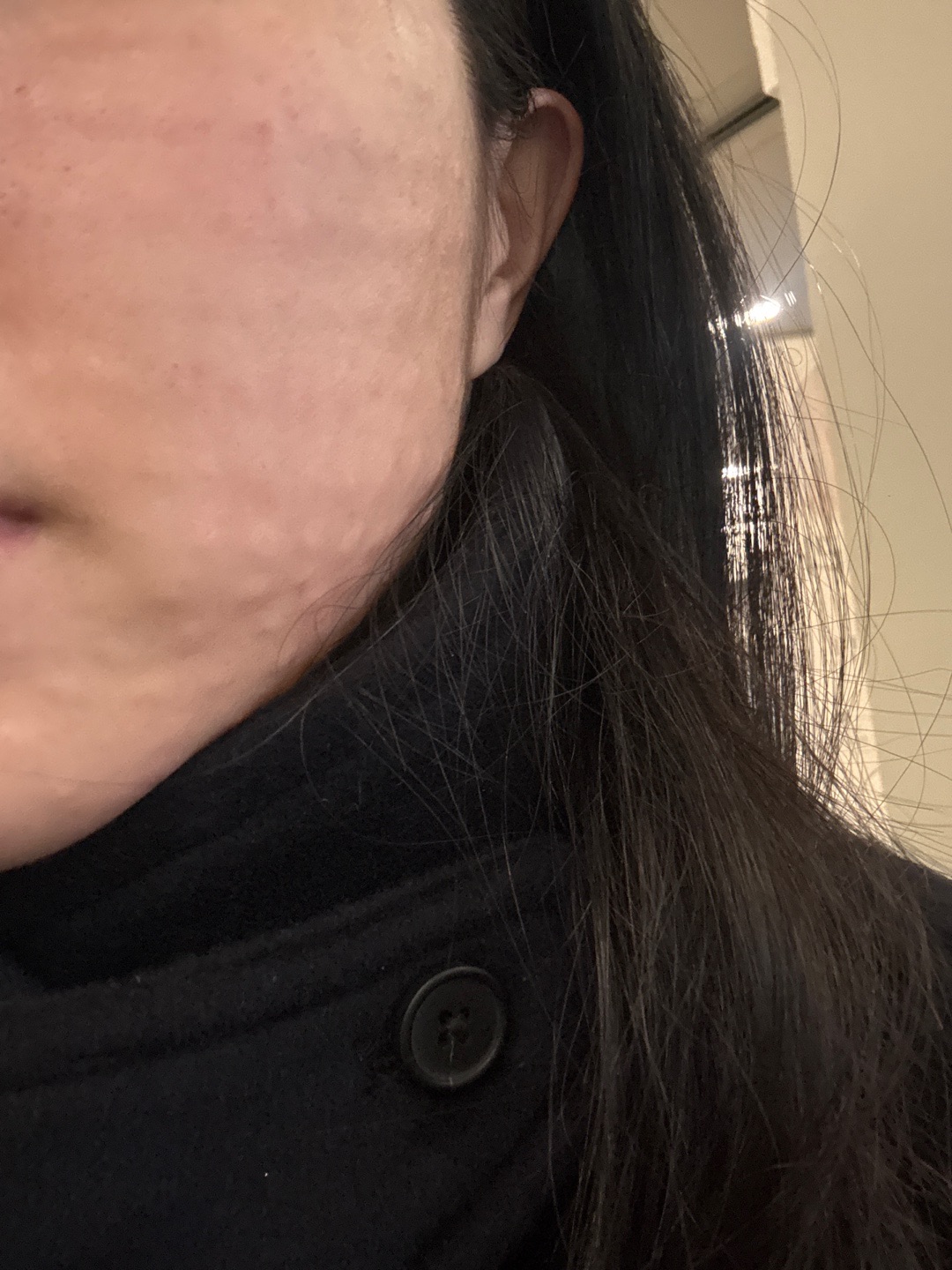 수술후기이미지