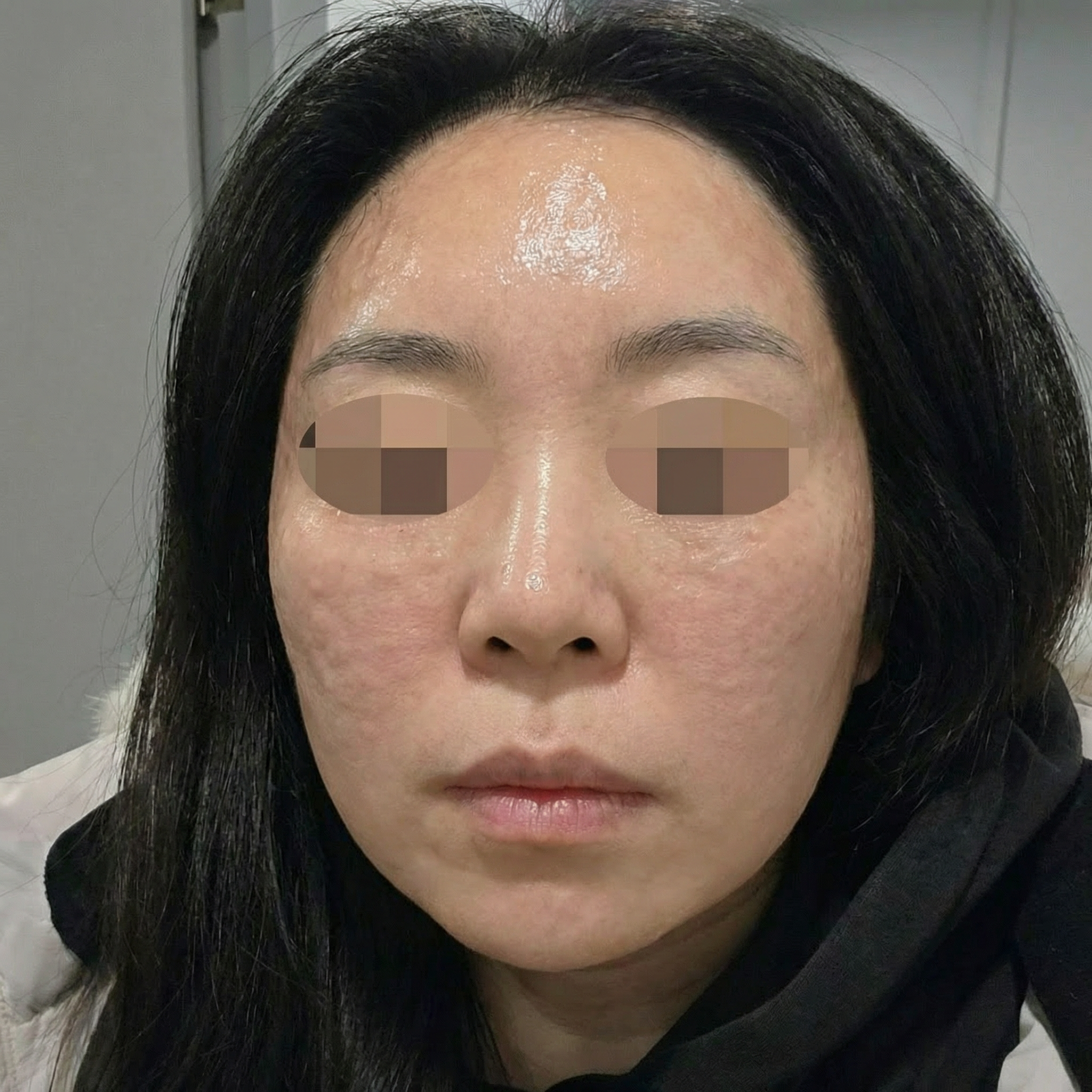 수술후기이미지