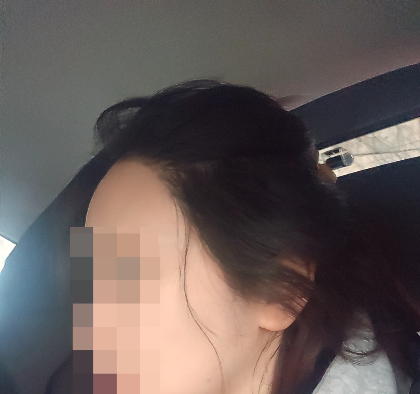 수술후기이미지