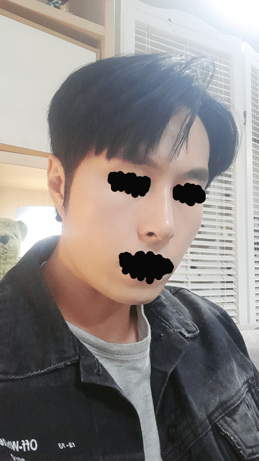 수술후기이미지