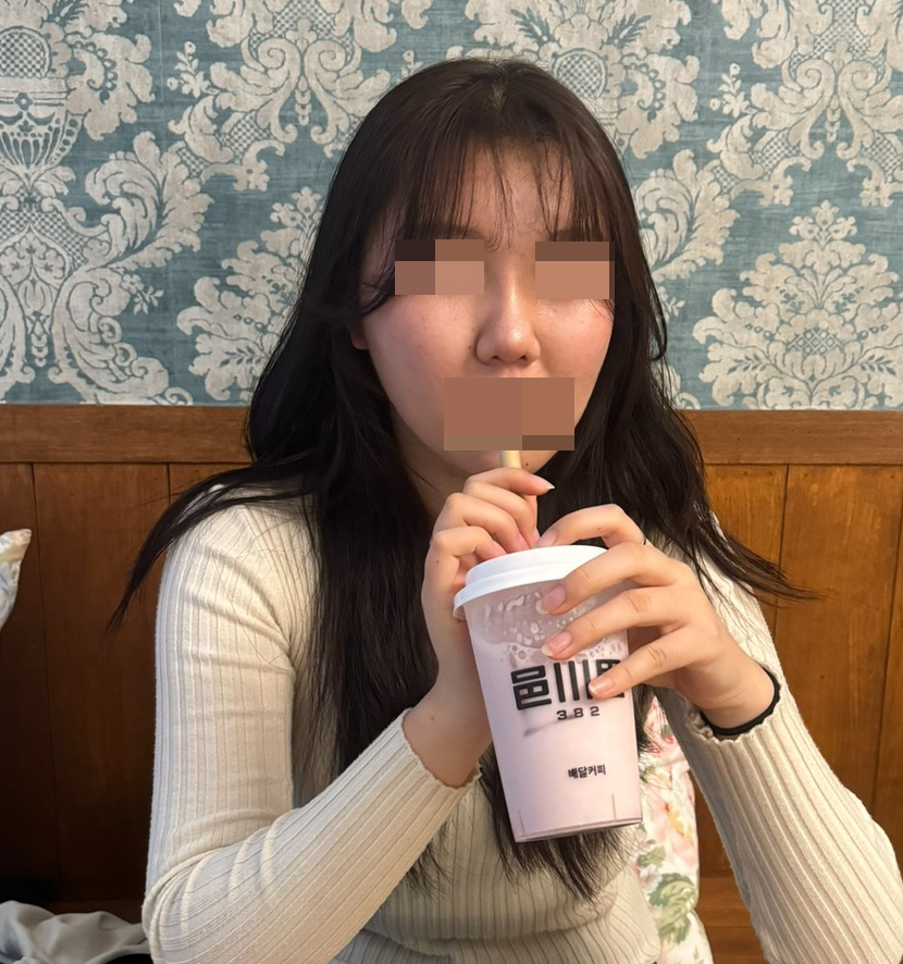 수술후기이미지