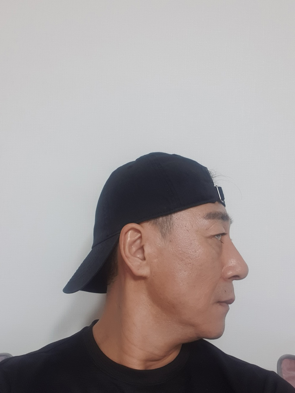 수술후기이미지