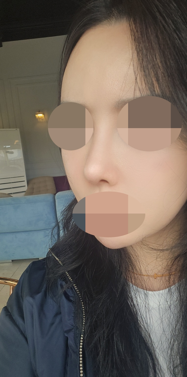 수술후기이미지