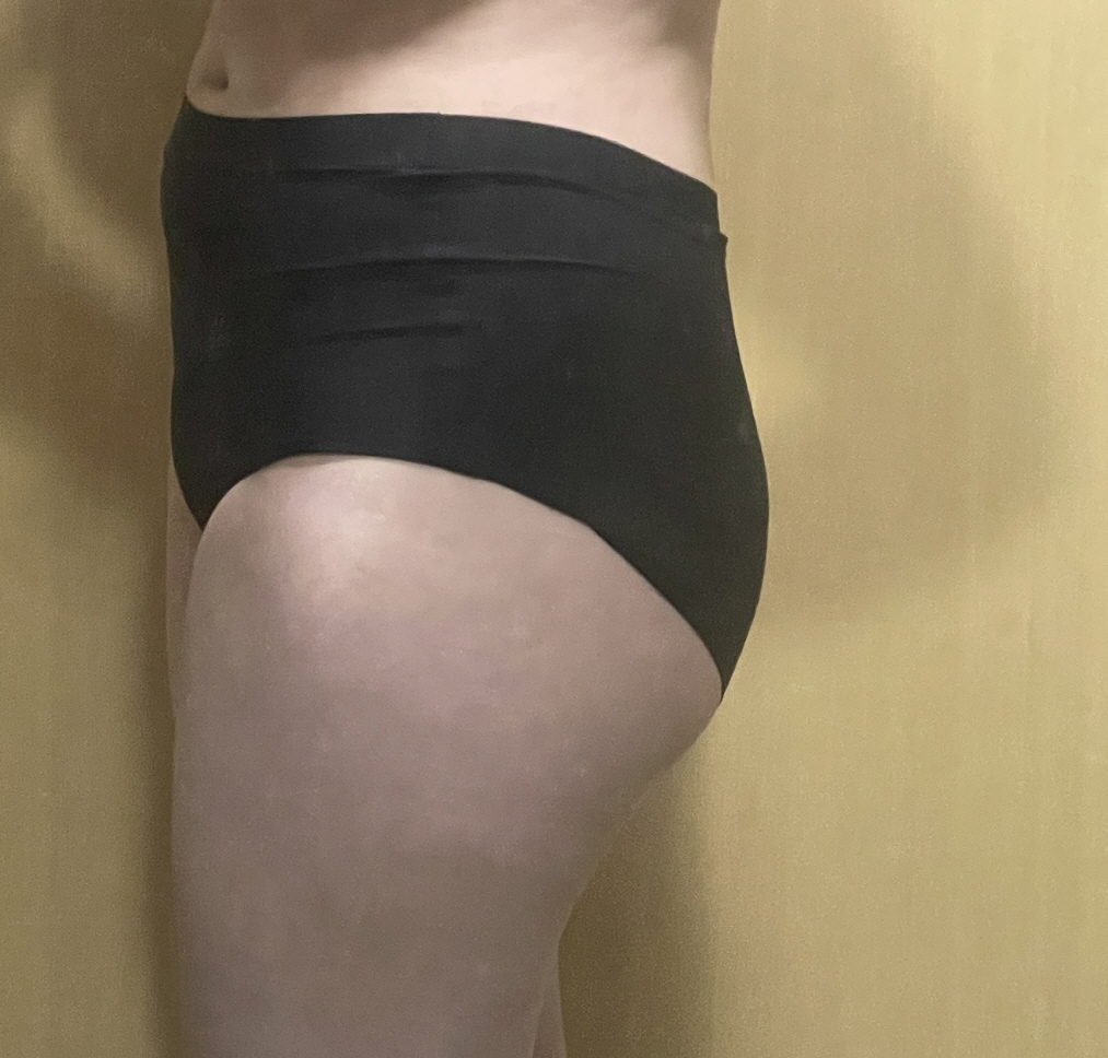 수술후기이미지