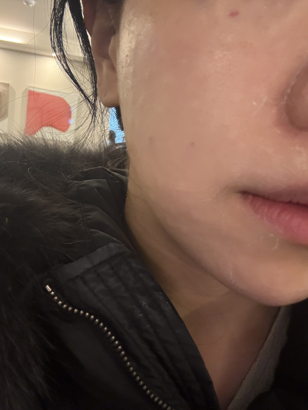 수술후기이미지