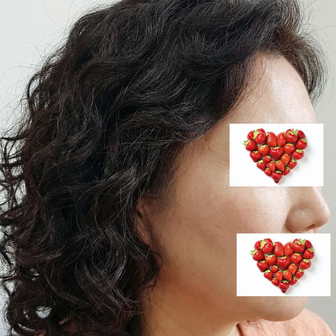 수술후기이미지