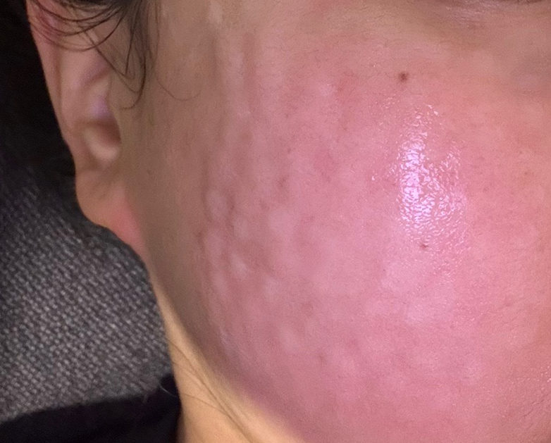 수술후기이미지