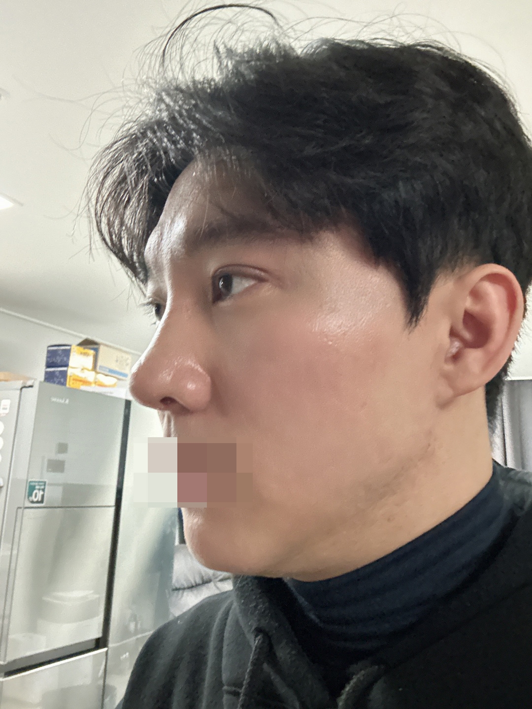 수술후기이미지