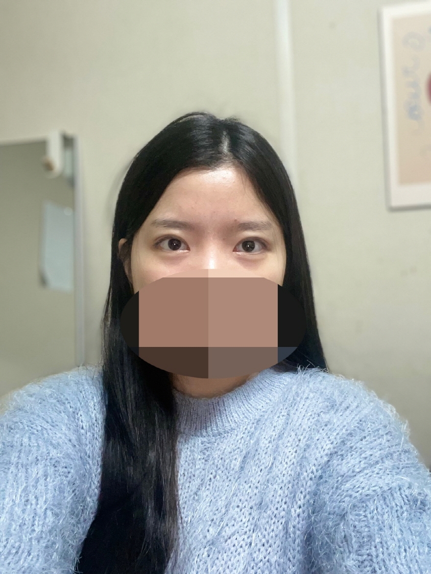 수술후기이미지