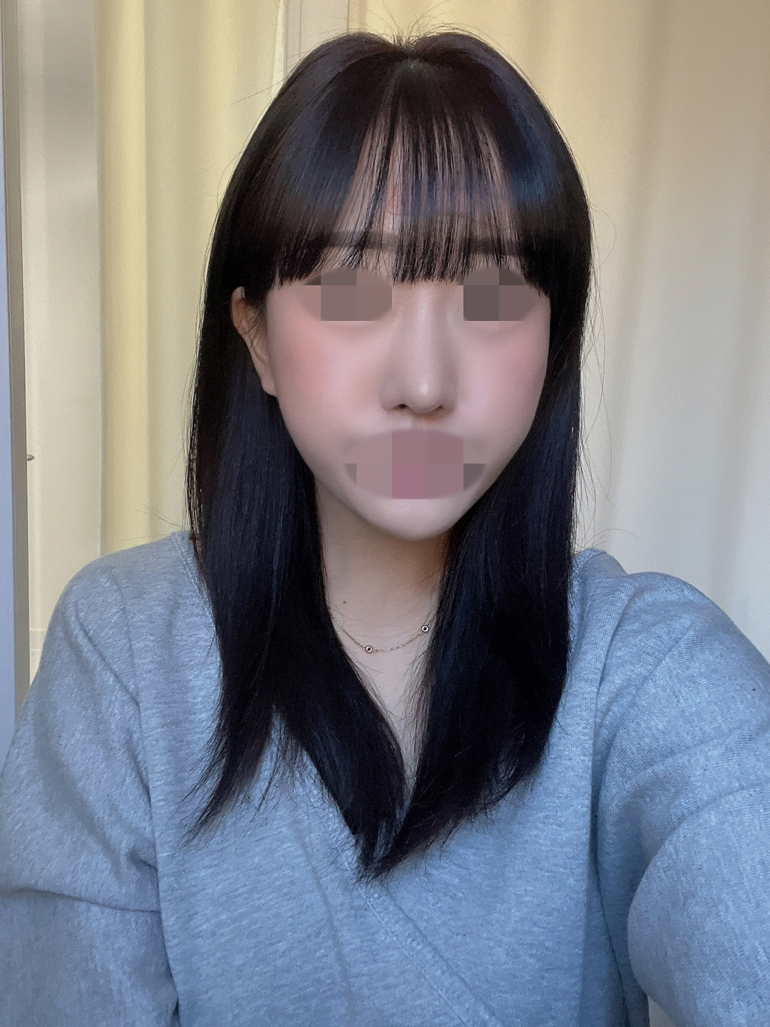 수술후기이미지