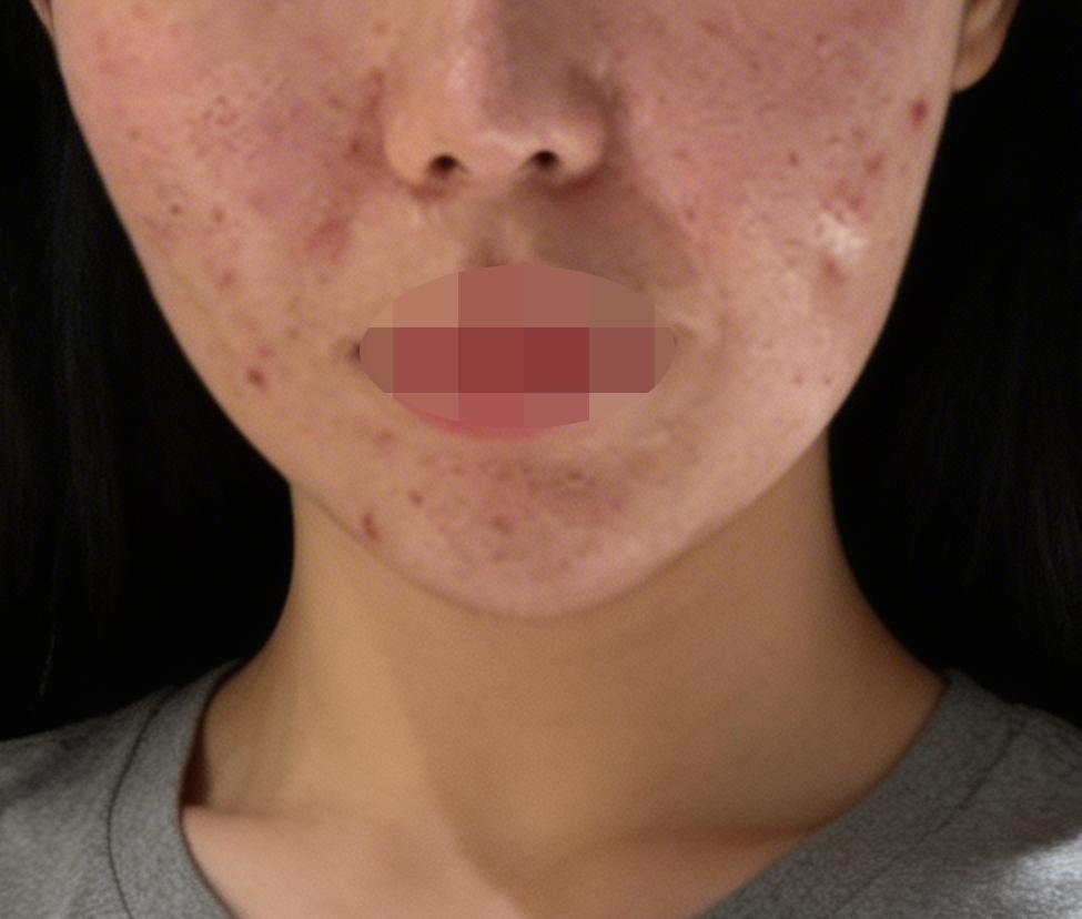 수술후기이미지