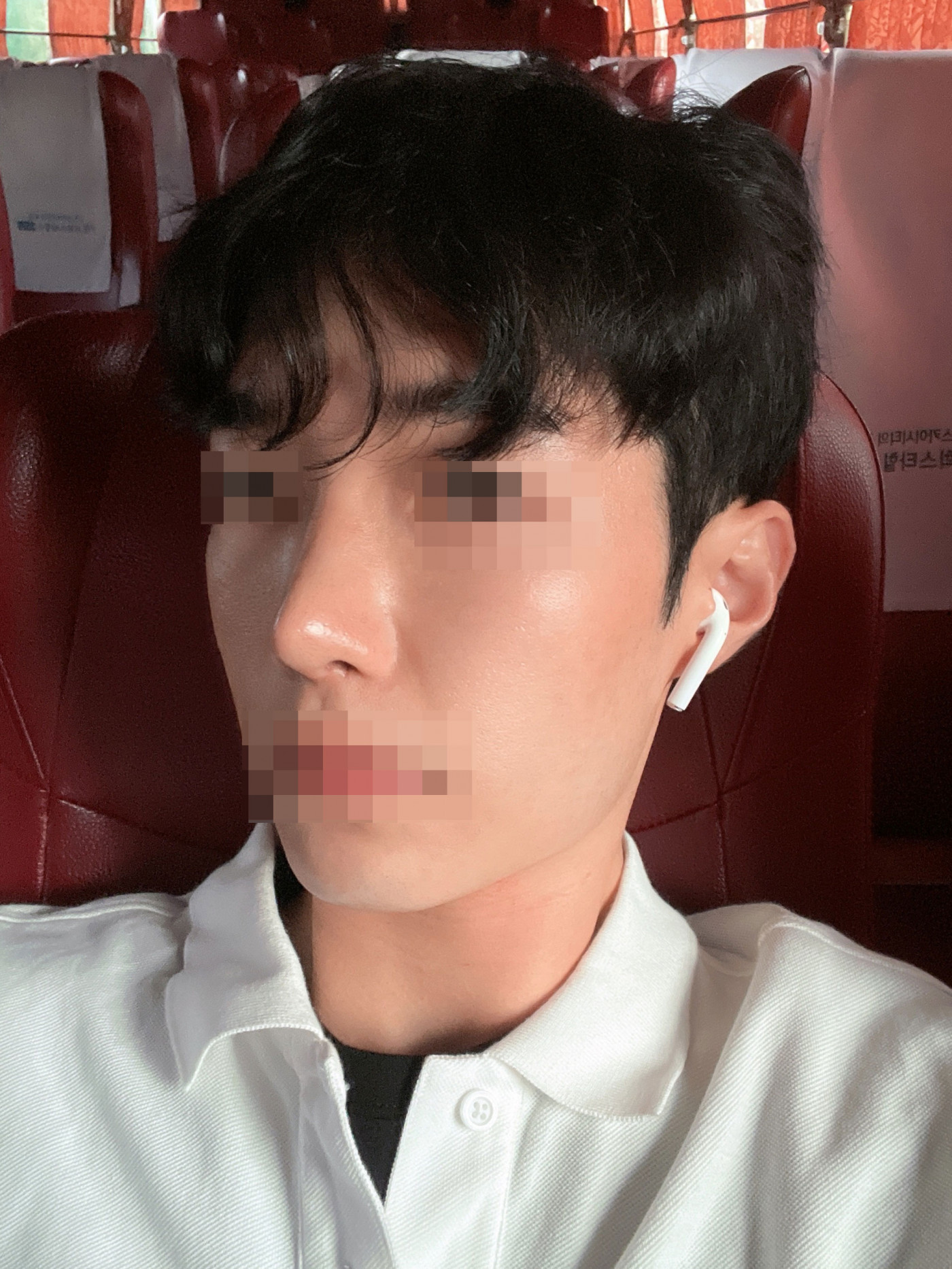 수술후기이미지