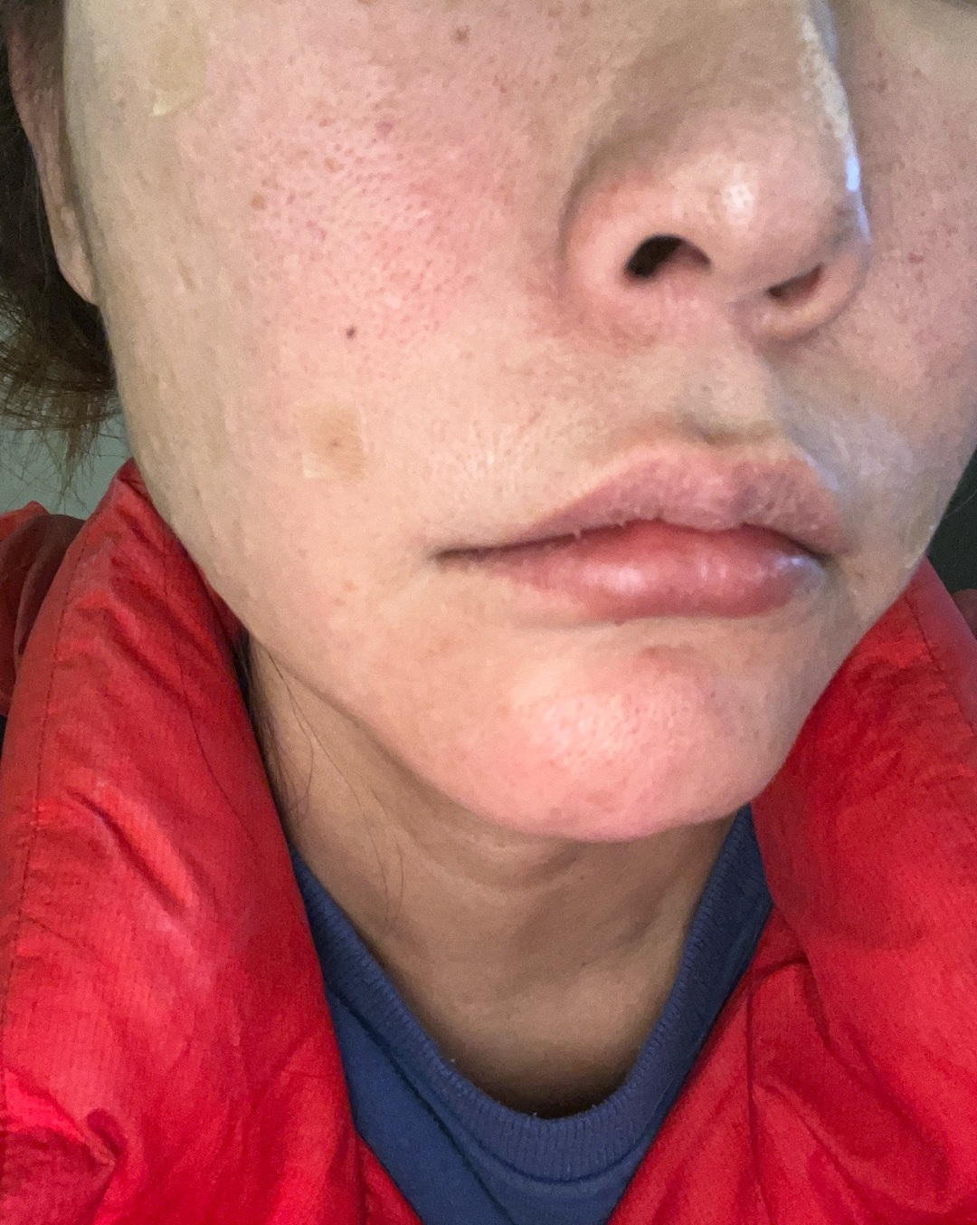 수술후기이미지