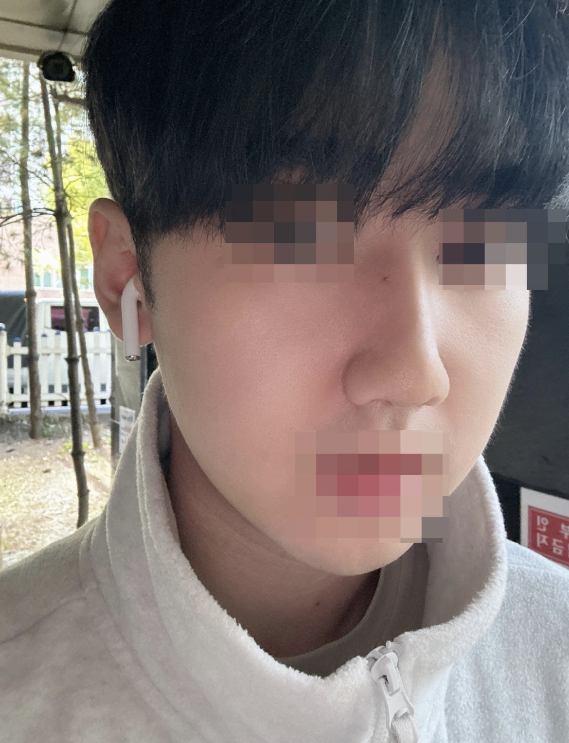 수술후기이미지