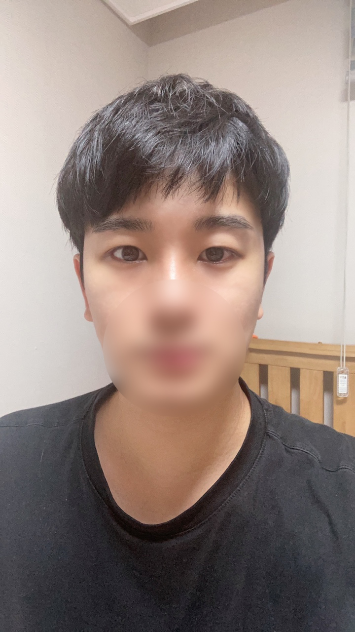 수술후기이미지