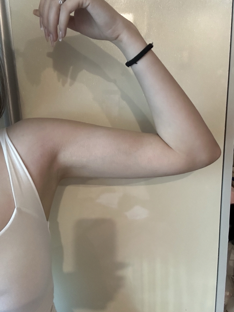 수술후기이미지