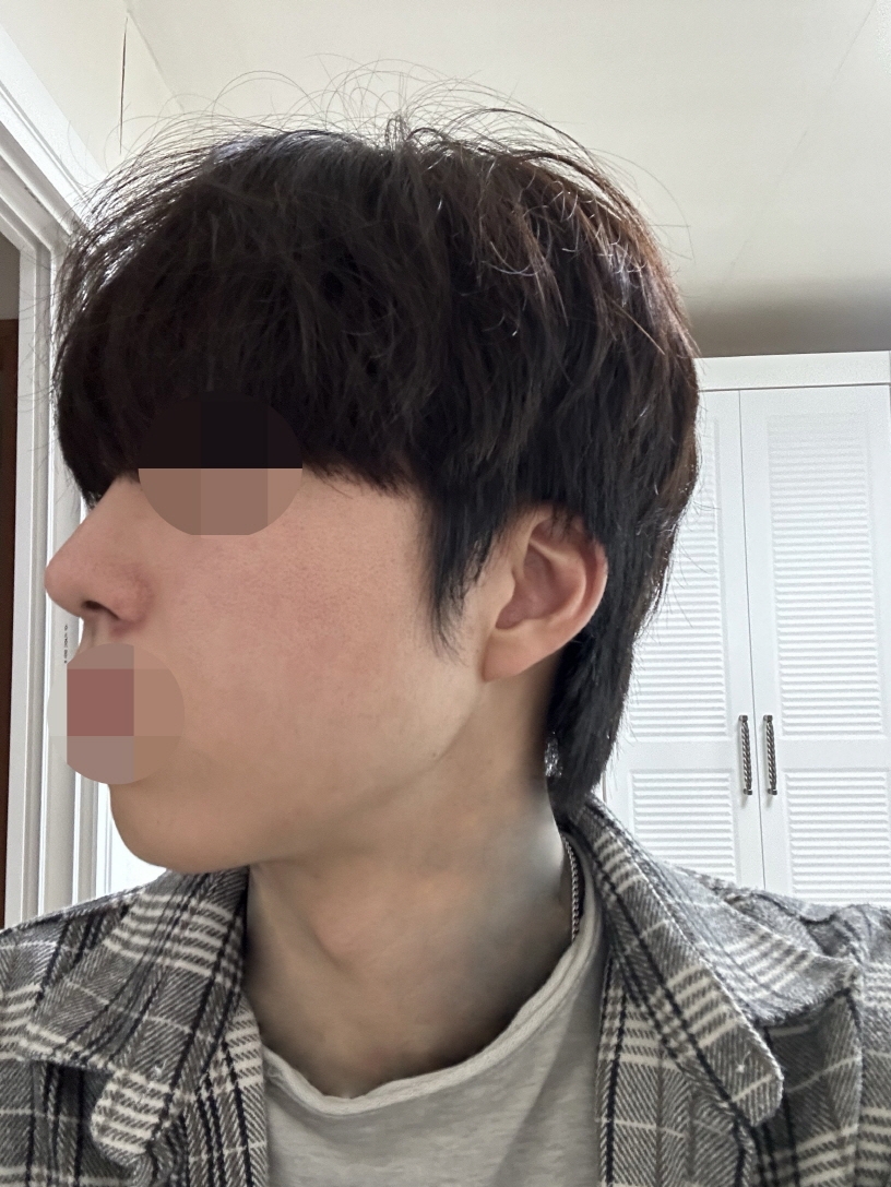 수술후기이미지