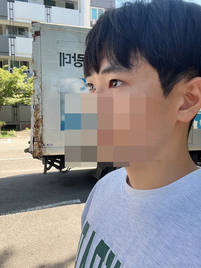 수술후기이미지