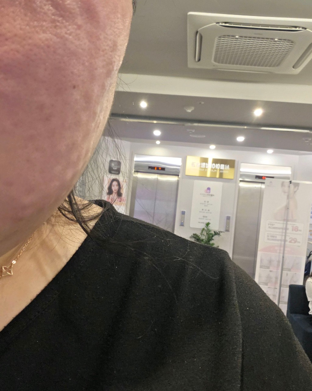 수술후기이미지