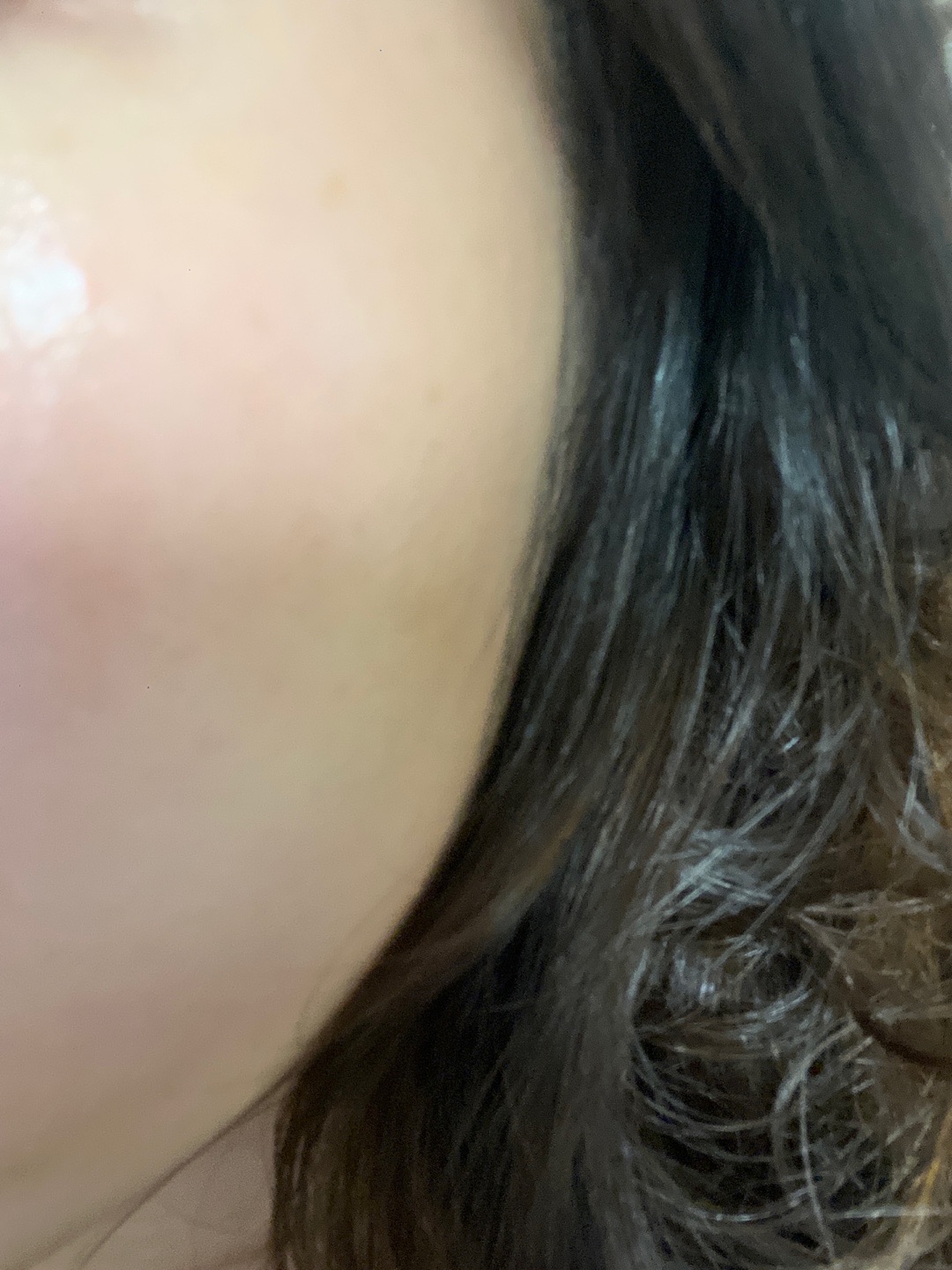 수술후기이미지