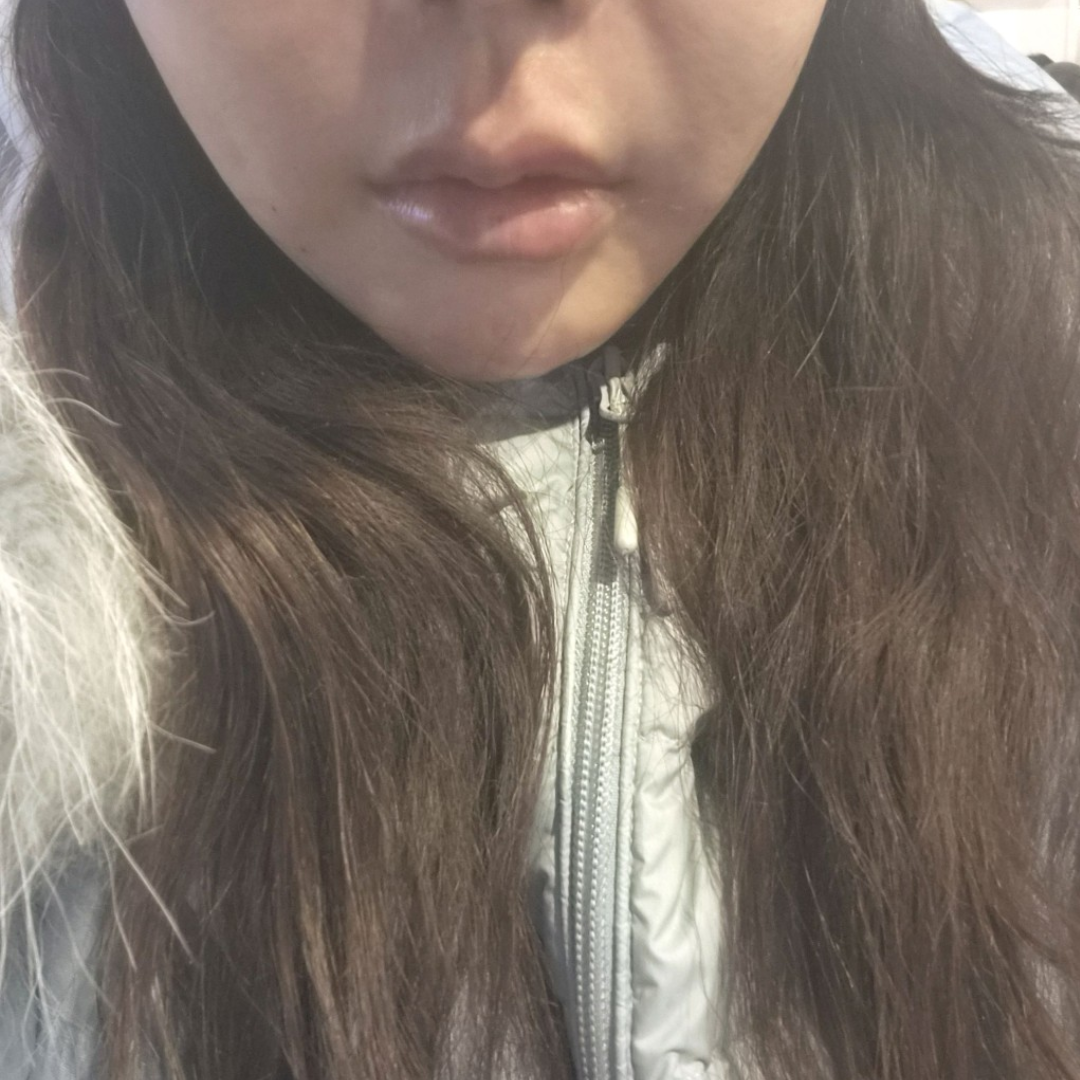 수술후기이미지