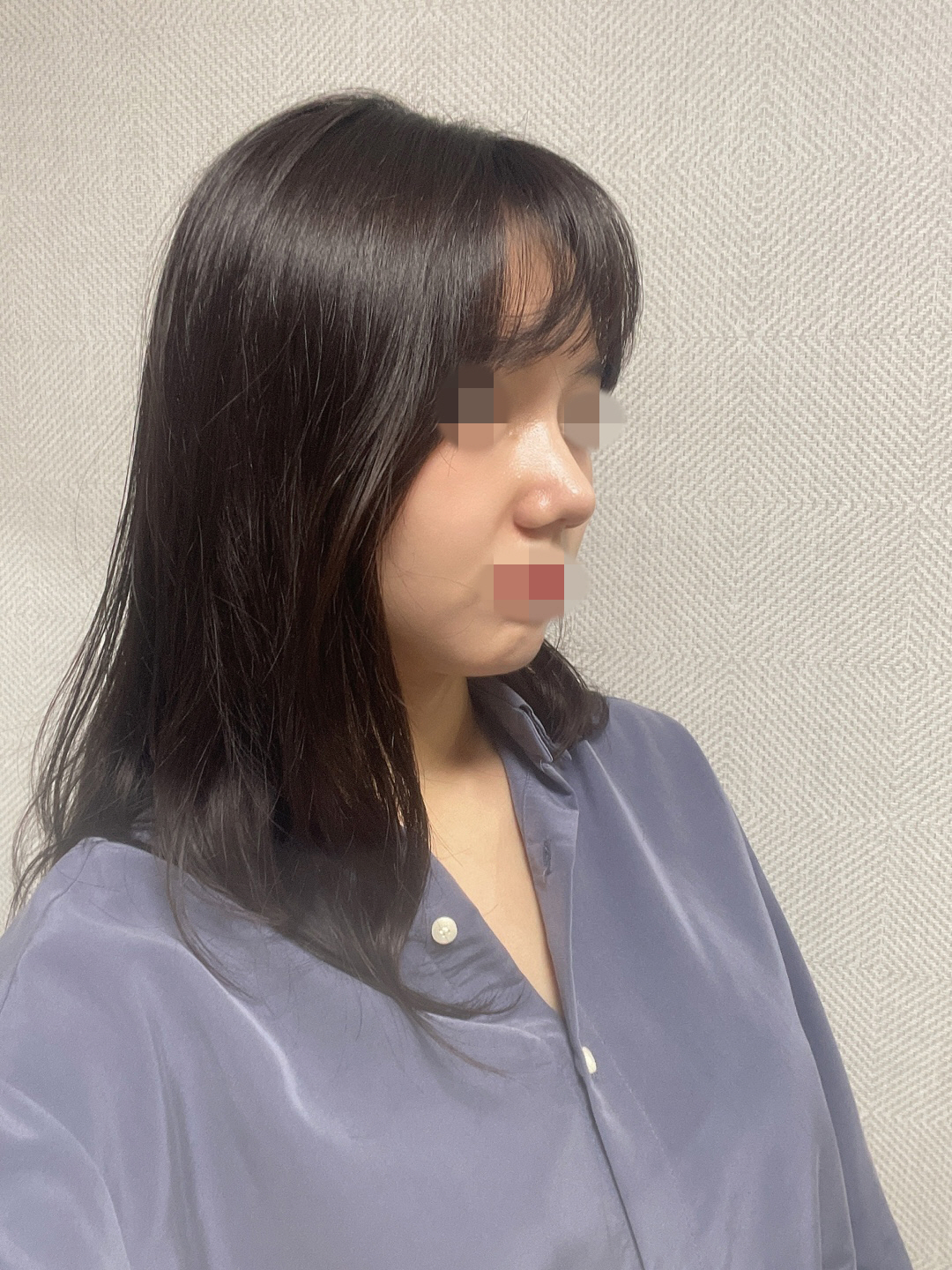 수술후기이미지