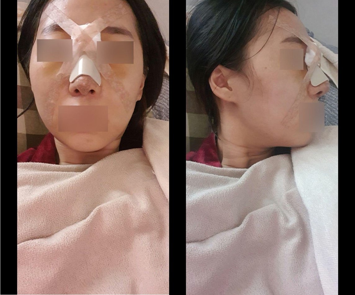 수술후기이미지