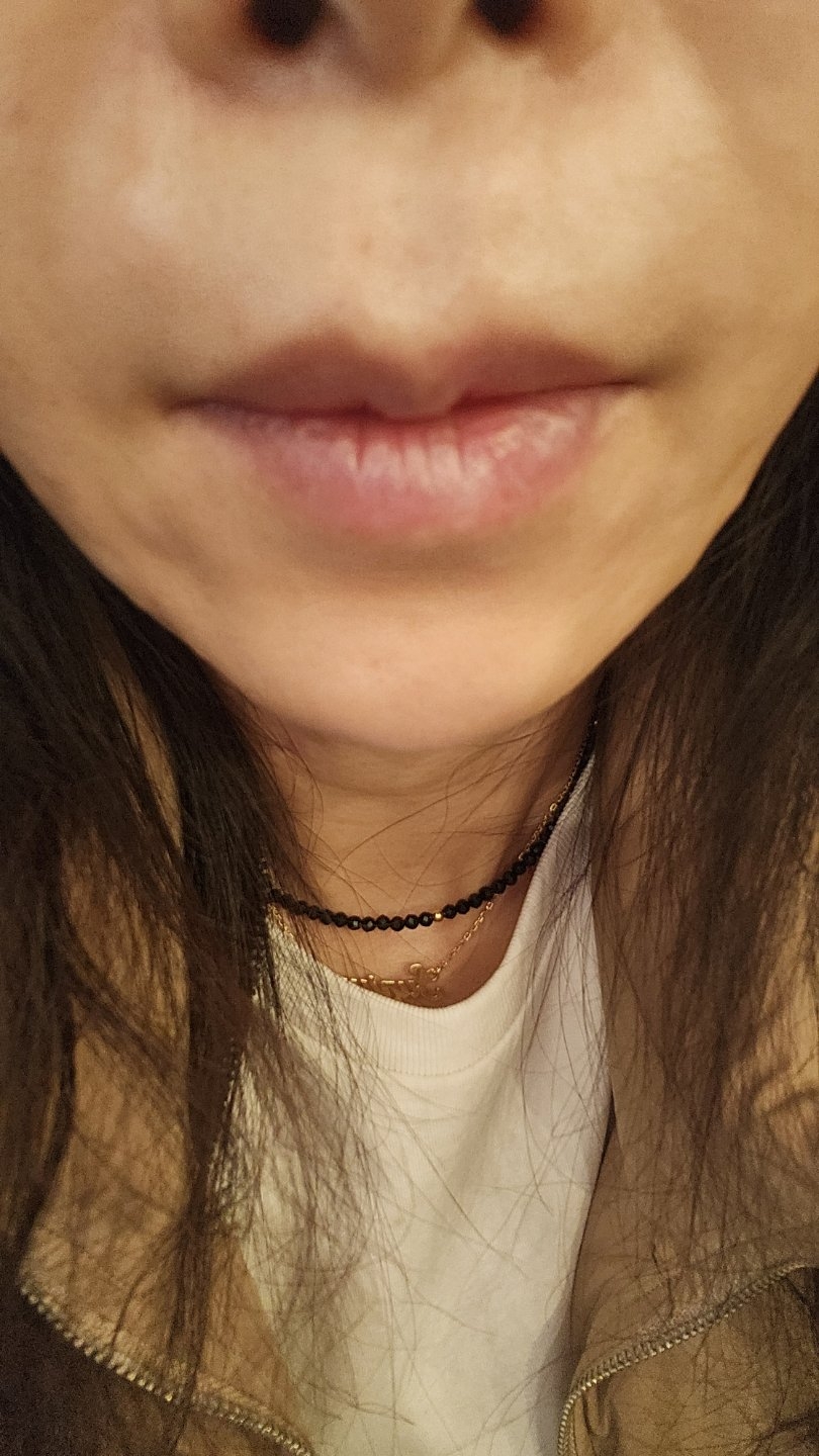 수술후기이미지