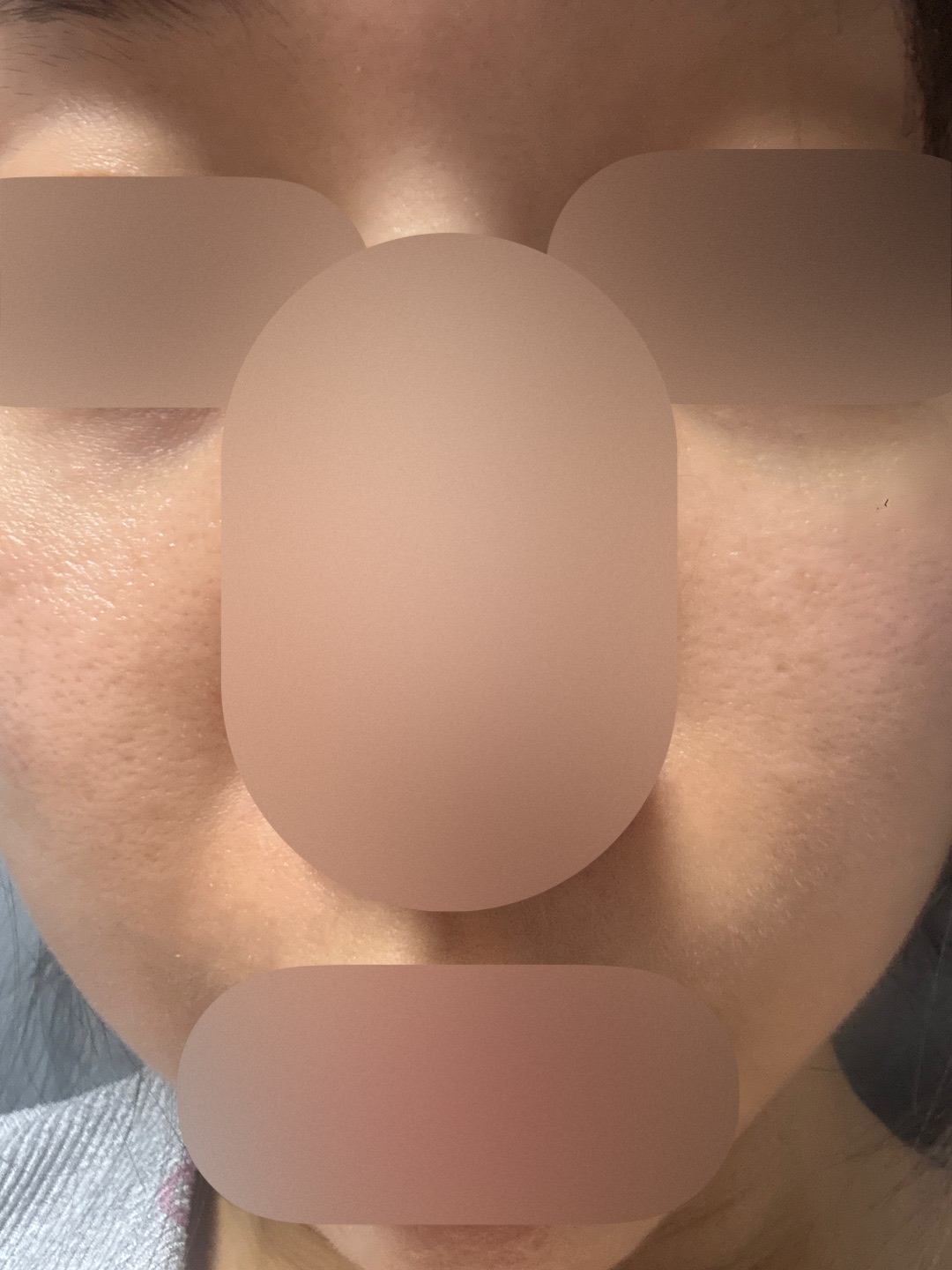 수술후기이미지