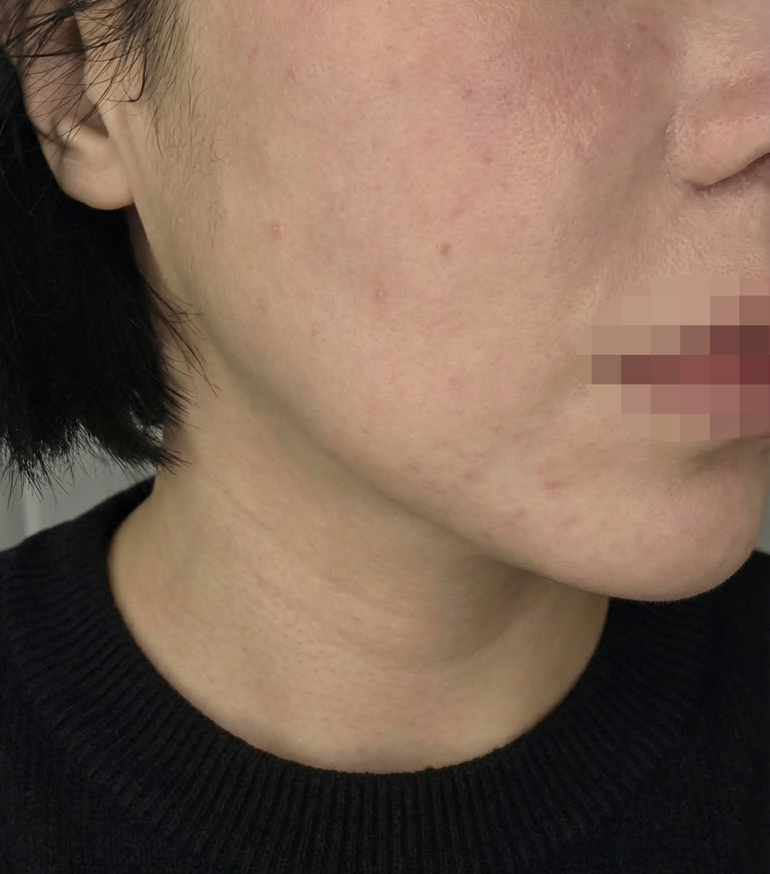 수술후기이미지