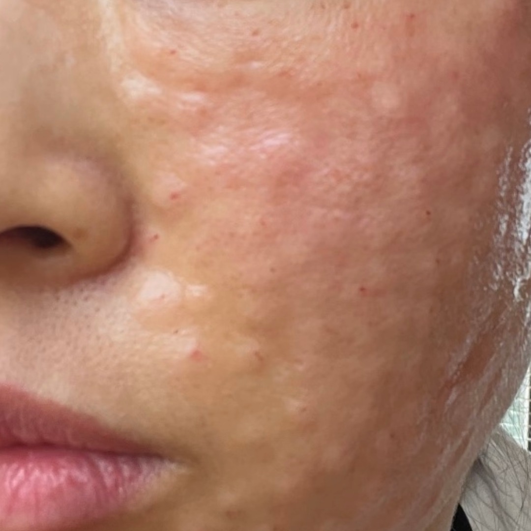 수술후기이미지