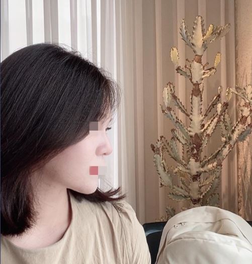 수술후기이미지