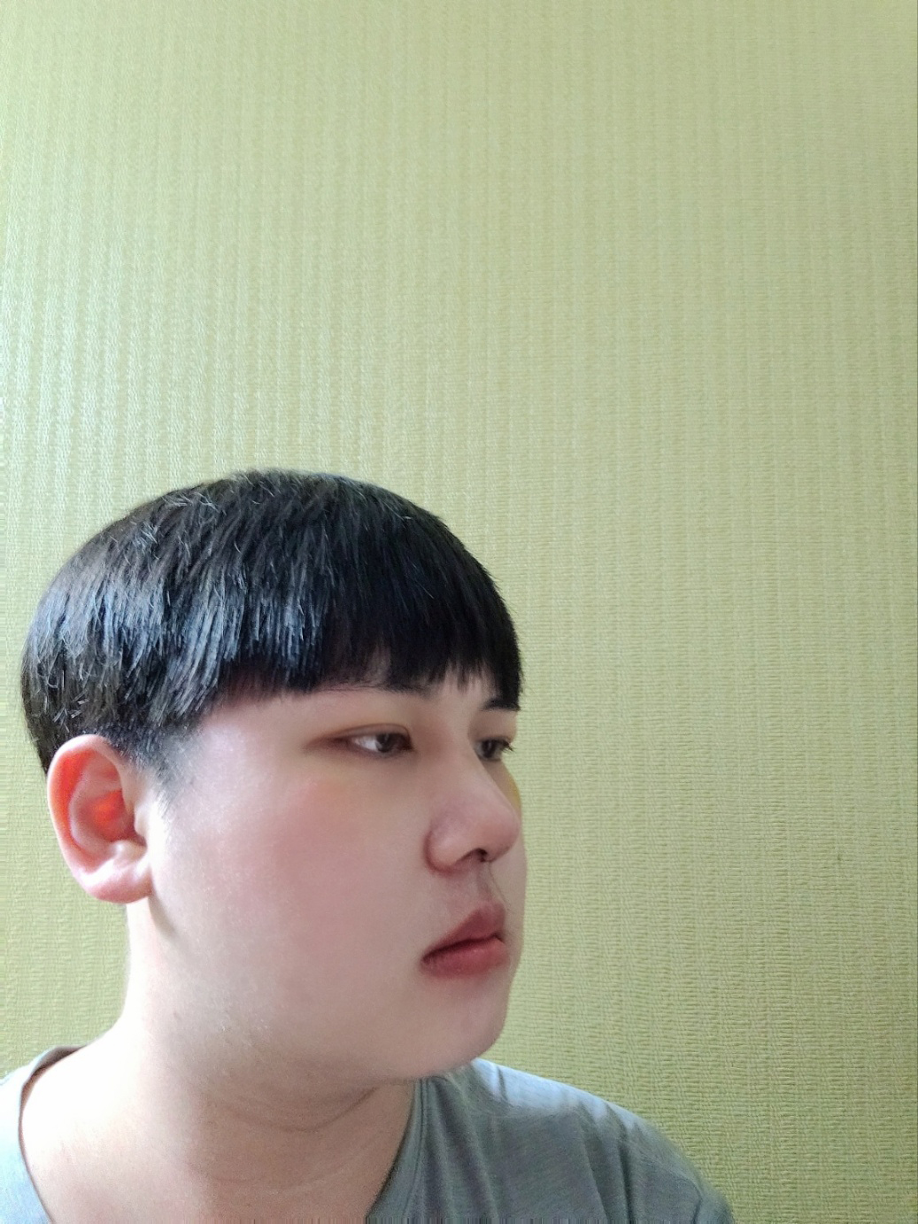 수술후기이미지