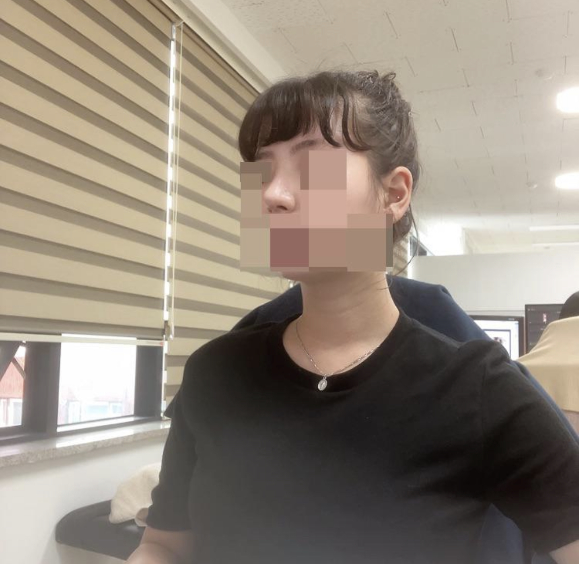 수술후기이미지