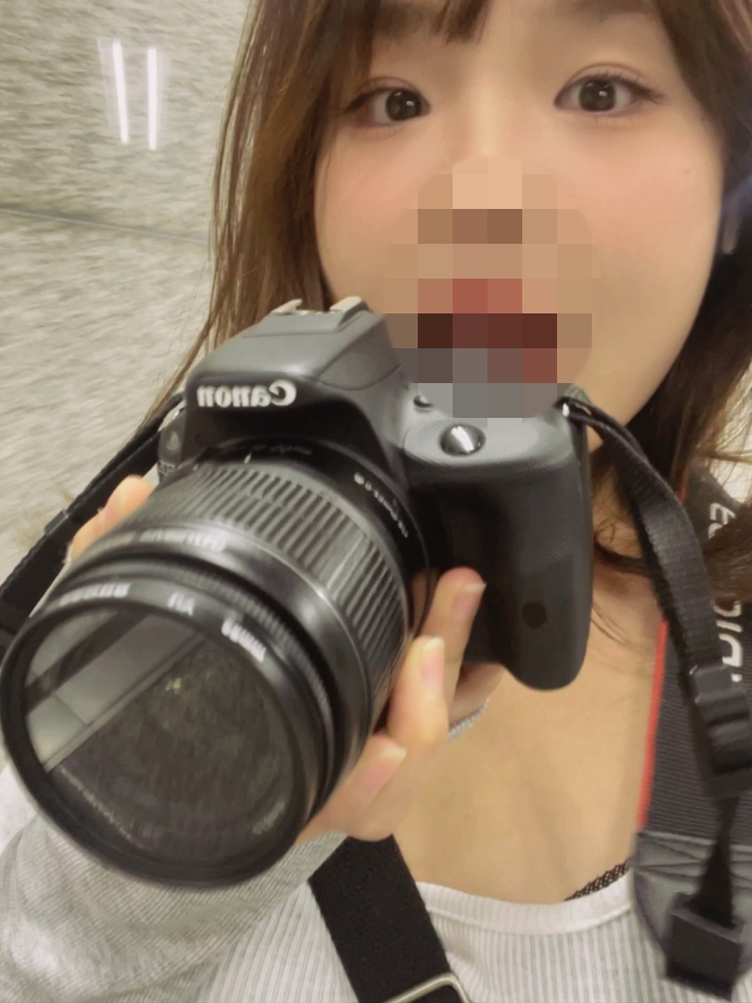 수술후기이미지