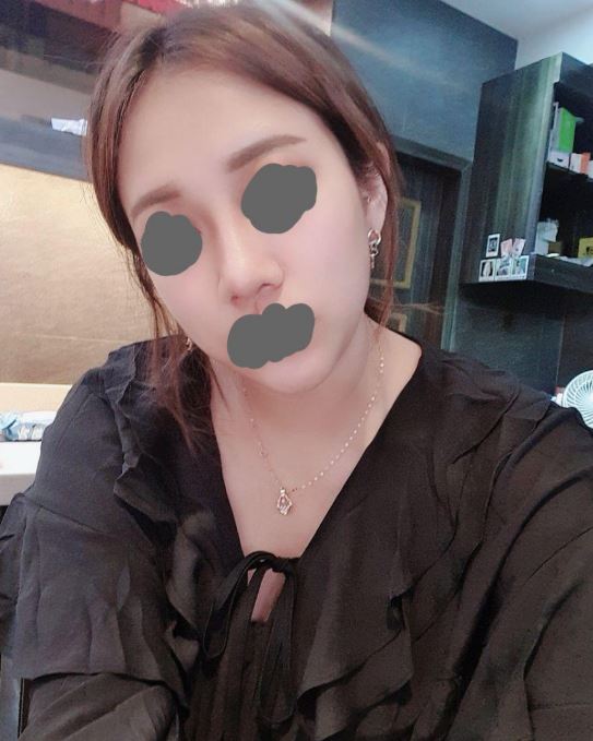 수술후기이미지