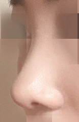 수술후기이미지